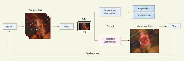 Deep Neural Network (DNN) Pipeline to Provide Video-Based Assessment of Skills