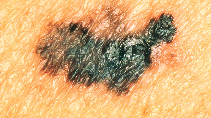 dermatology img