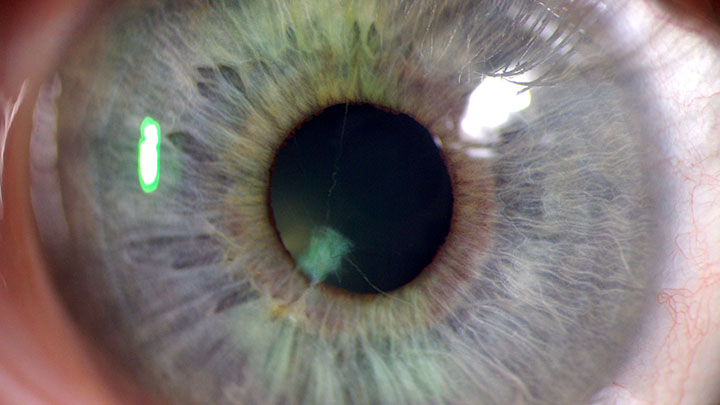 ophthalmology img