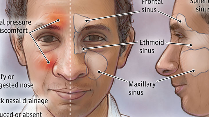 otolaryngology img